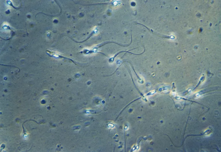 Insan spermatozoa