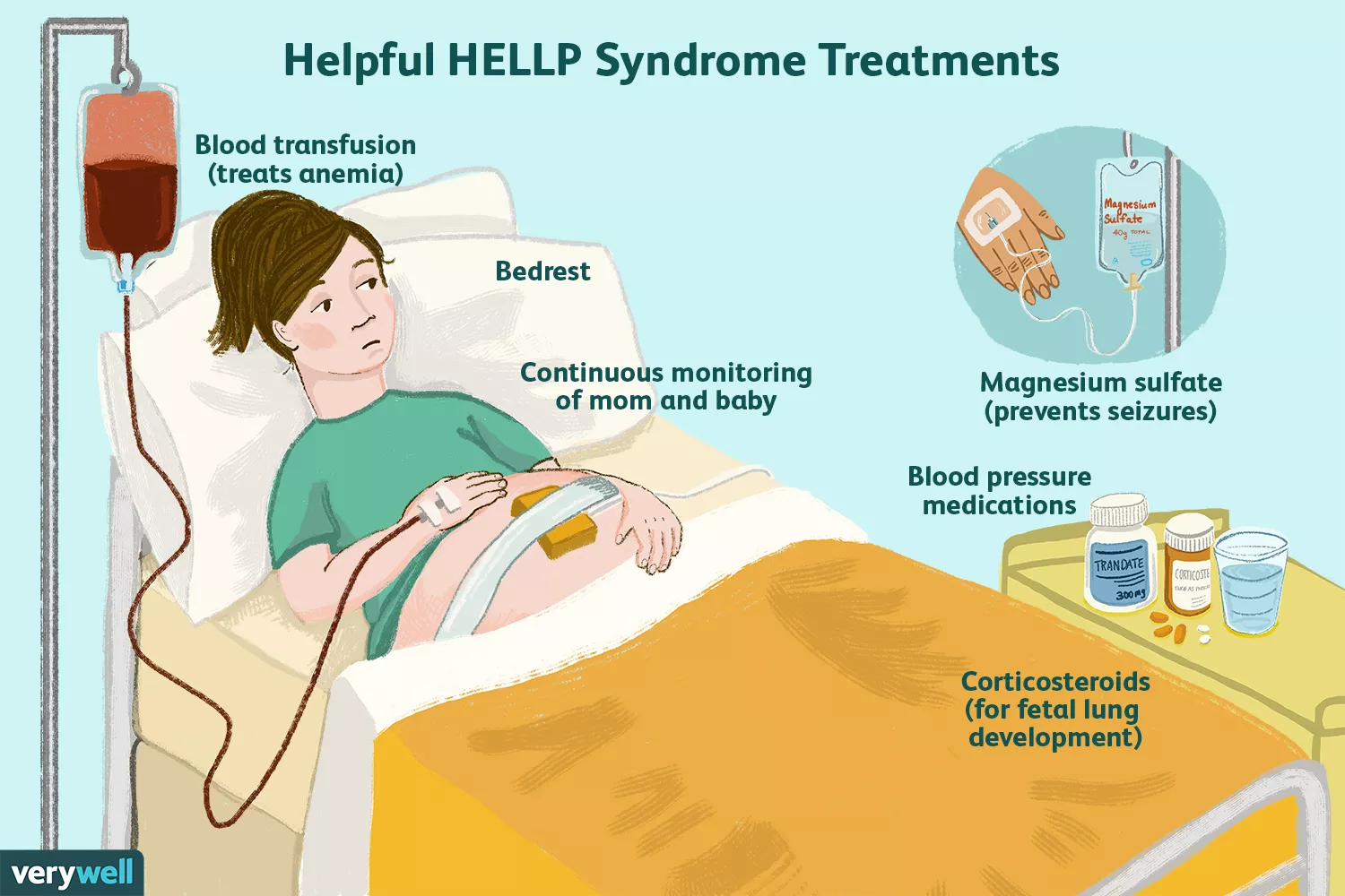 Helpful HELLP syndrome treatments